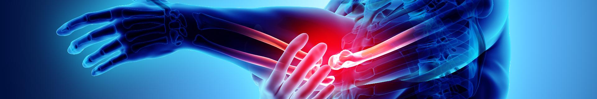 Ergonomics for the Workplace