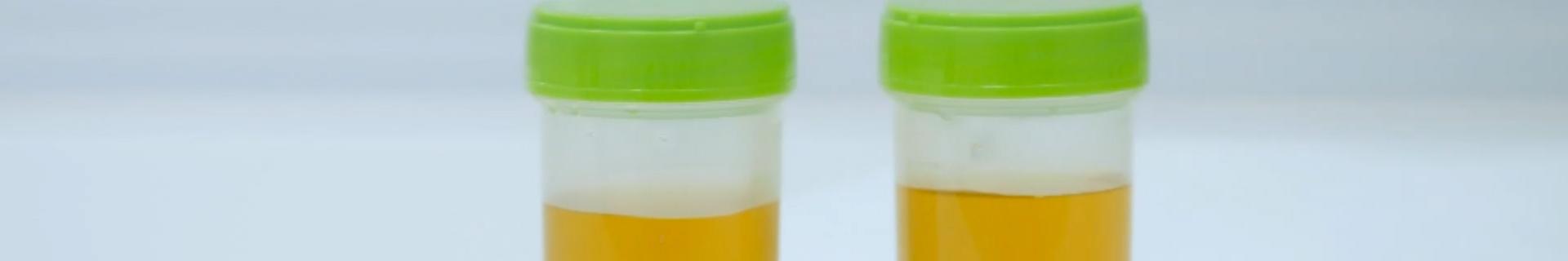 DOT “Reasonable Suspicion” Testing Overview for Managers and Supervisors (US)