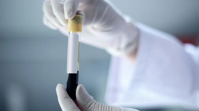 Bloodborne Pathogens in First Response Environments